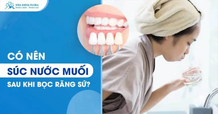 Hỏi Đáp: Có Nên Súc Nước Muối Sau Khi Bọc Răng Sứ? 1