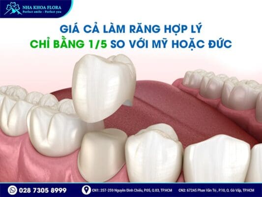 Kiều Bào về nước làm răng sứ - ảnh 3