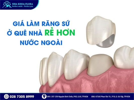 loại răng sứ kiều bào chọn - ảnh 2