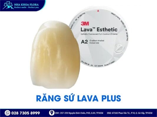 loại răng sứ kiều bào chọn - ảnh 3