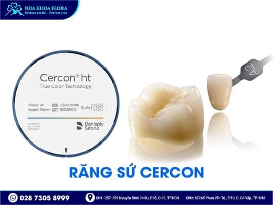 loại răng sứ kiều bào chọn - ảnh 4