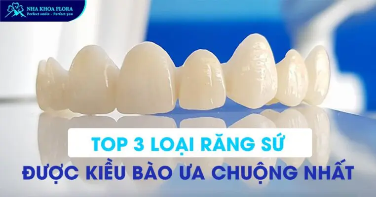 Top 3 loại răng sứ được Kiều Bào ưa chuộng nhất 1