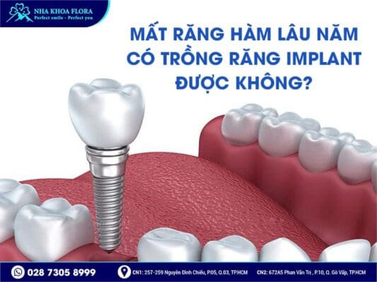 mất răng hàm lâu năm - ảnh 5