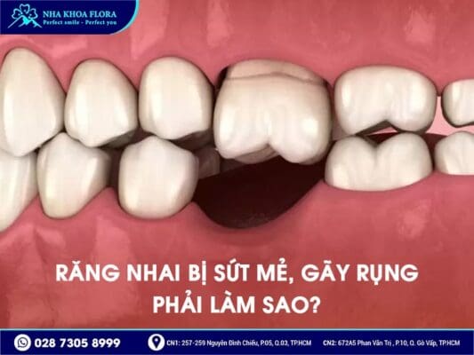 Mất răng nhai nên trồng răng Implant hay bắc cầu răng sứ? - ảnh 2