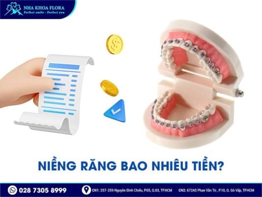 niềng răng bao nhiêu tiền - ảnh 1
