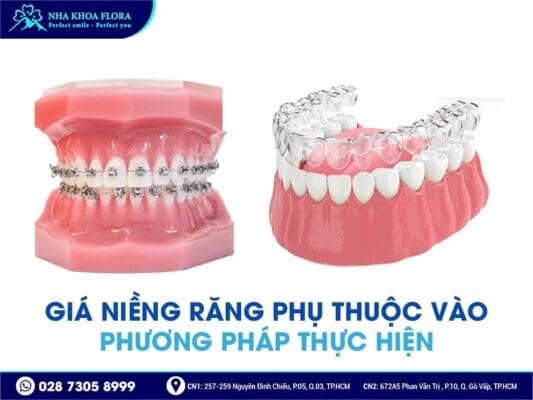 niềng răng bao nhiêu tiền - ảnh 2