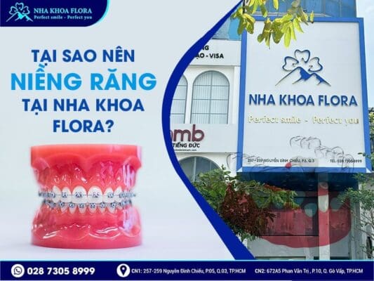 niềng răng bao nhiêu tiền - ảnh 5