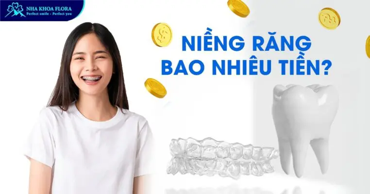 Niềng răng bao nhiêu tiền? Bảng giá chỉnh nha 2024 3