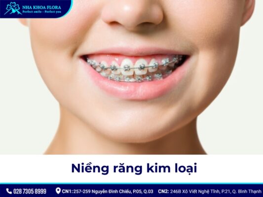 niềng răng có đau không - ảnh 2