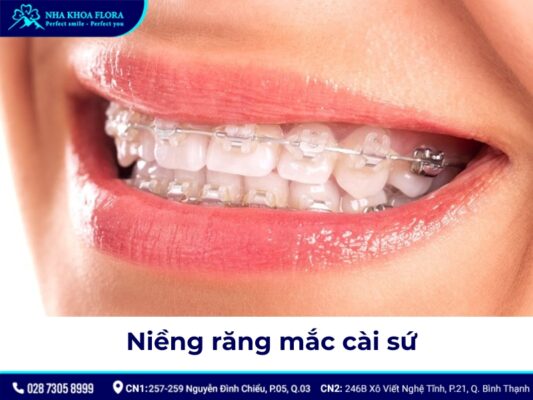 niềng răng có đau không - ảnh 3