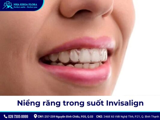 niềng răng có đau không - ảnh 6