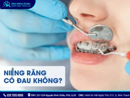 niềng răng có đau không - ảnh 7