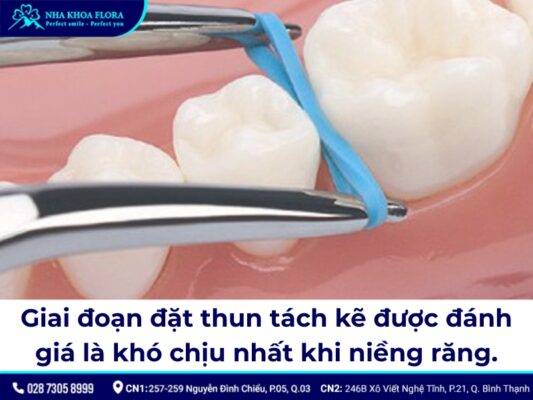niềng răng có đau không - ảnh 8