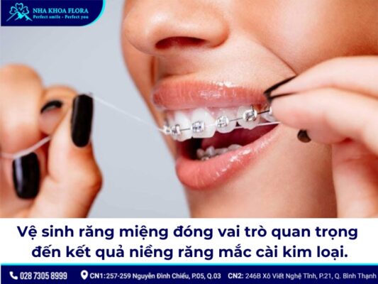 niềng răng mắc cài kim loại - ảnh 6 niềng răng mắc cài kim loại - ảnh 6