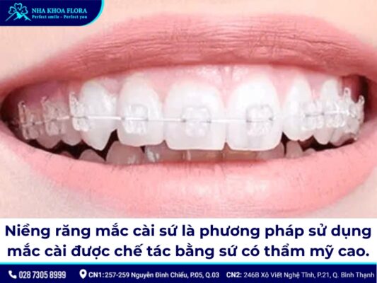 niềng răng mắc cài sứ - ảnh 1 niềng răng mắc cài sứ - ảnh 1