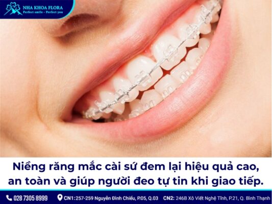 niềng răng mắc cài sứ - ảnh 2 niềng răng mắc cài sứ - ảnh 2