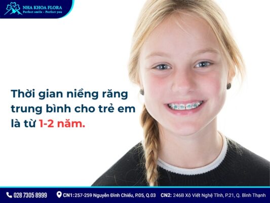 niềng răng mất bao lâu - ảnh 1