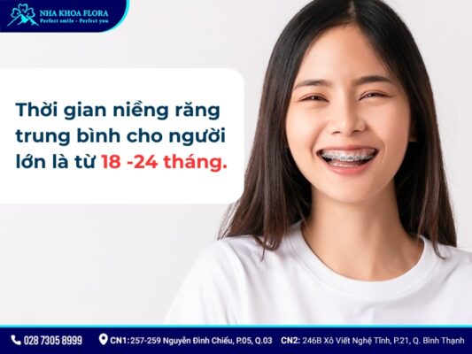niềng răng mất bao lâu - ảnh 2