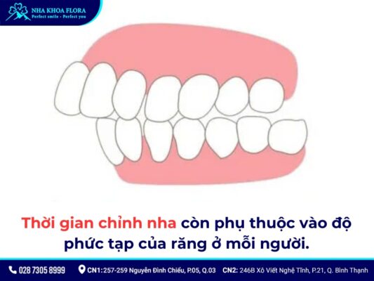 niềng răng mất bao lâu - ảnh 4