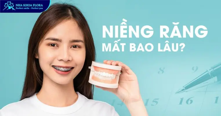 niềng răng mất bao lâu