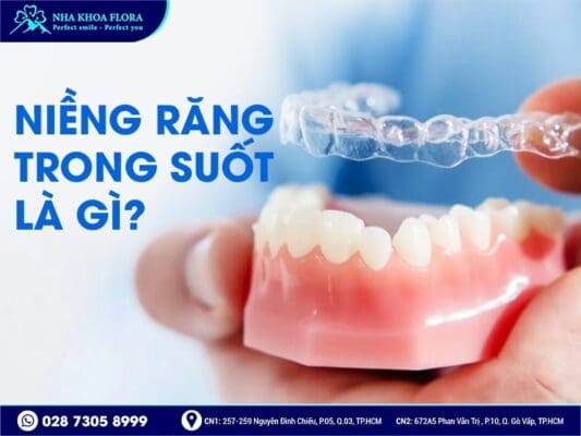 niềng răng trong suốt - ảnh 1