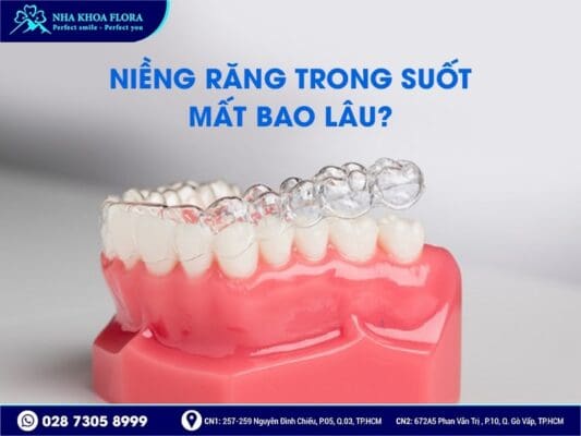 niềng răng trong suốt - ảnh 3