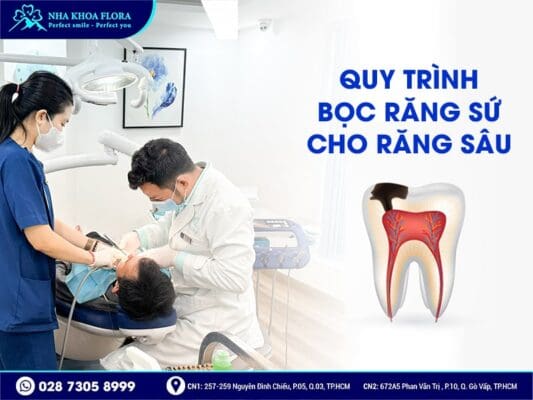 Quy trình bọc răng sứ cho răng sâu - ảnh 3 Quy trình bọc răng sứ cho răng sâu - ảnh 3