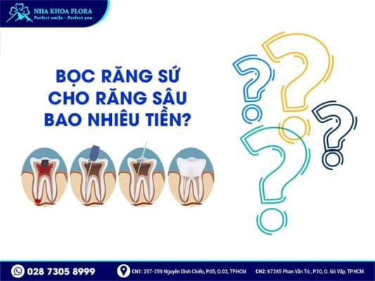 Quy trình bọc răng sứ cho răng sâu - ảnh 5 Quy trình bọc răng sứ cho răng sâu - ảnh 5