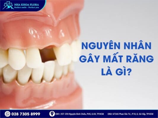 Phương pháp trồng răng giả nào tốt nhất hiện nay? - ảnh 1