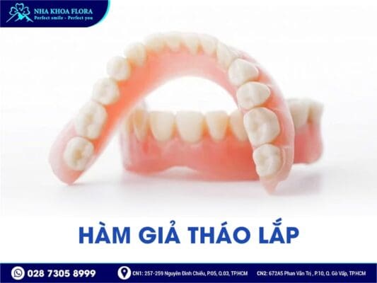 Phương pháp trồng răng giả nào tốt nhất hiện nay? - ảnh 5