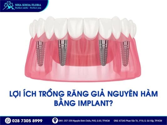 trồng răng nguyên hàm - ảnh 1