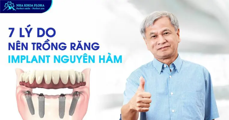 7 lý do nên trồng răng Implant nguyên hàm? – Nha khoa Flora 3
