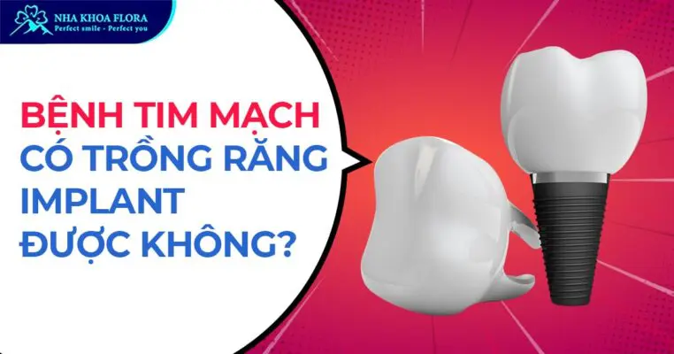Bệnh tim mạch có trồng răng Implant được không? 1