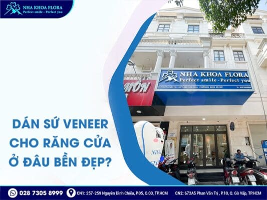 dán sứ Veneer 2 răng cửa - ảnh 4