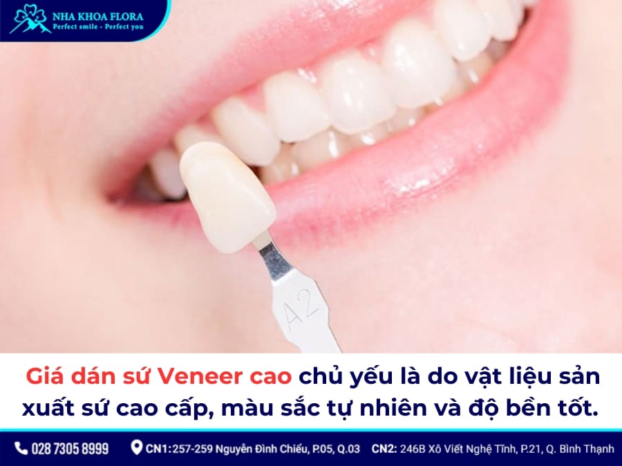 dán sứ veneer giá bao nhiêu