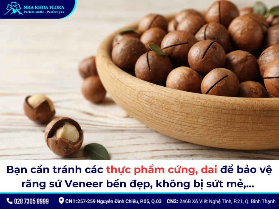 dán sứ veneer giá bao nhiêu