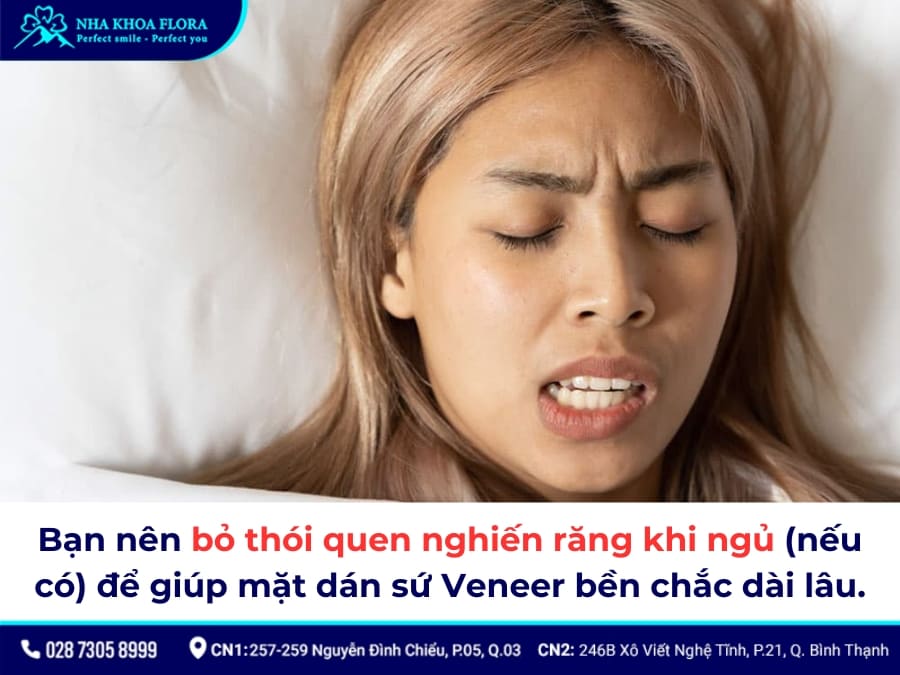 dán sứ veneer giá bao nhiêu
