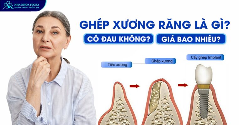 ghép xương răng