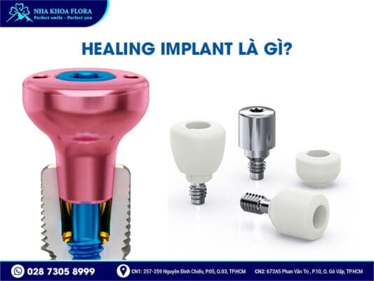 Healing Implant - ảnh 1