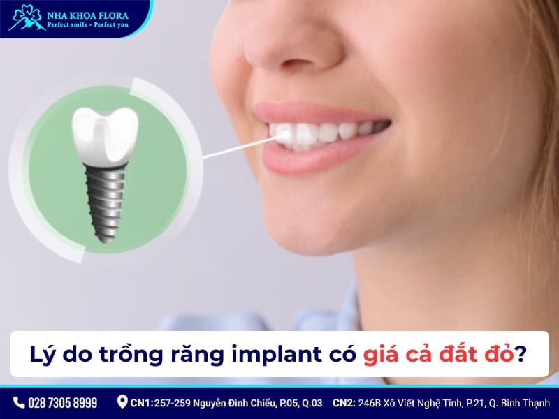 Lý do trồng răng implant có giá cả đắt đỏ