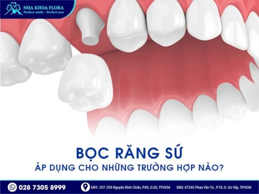 lưu ý làm răng sứ đón Tết - ảnh 1