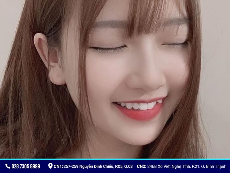 mẫu răng sứ đẹp