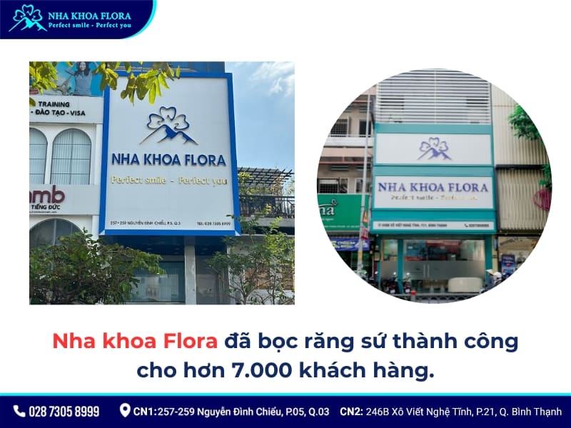 mẫu răng sứ đẹp