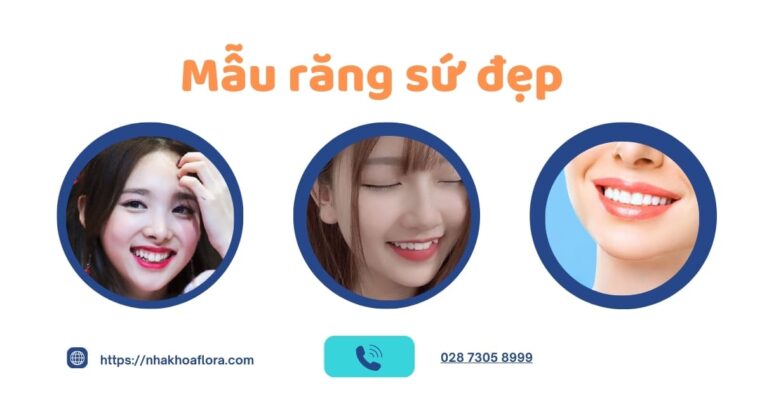 mẫu răng sứ đẹp