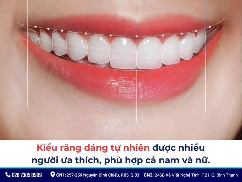 mẫu răng sứ đẹp