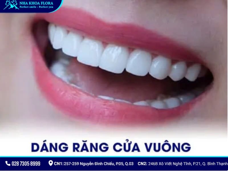 mẫu răng sứ đẹp