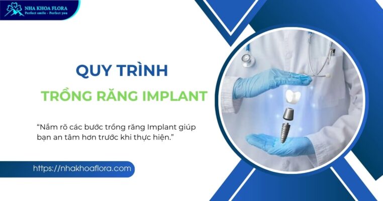 Quy trình trồng răng Implant