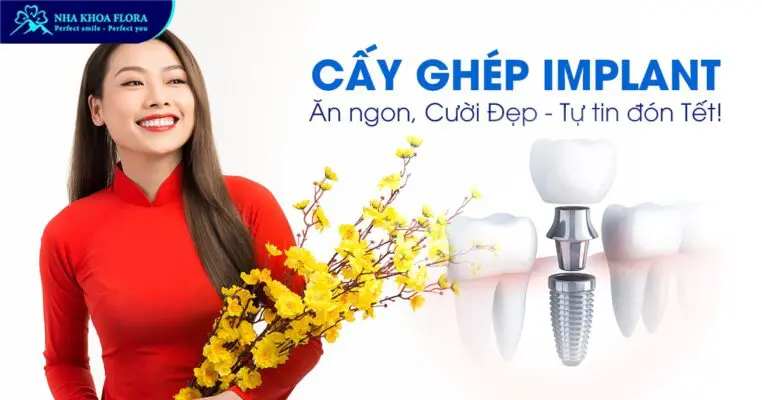Cấy ghép Implant: Ăn ngon, Cười Đẹp – Tự tin đón Tết! 3