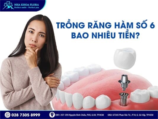 trồng răng hàm số 6 giá bao nhiêu - ảnh 2 trồng răng hàm số 6 giá bao nhiêu - ảnh 2