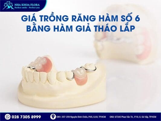 trồng răng hàm số 6 giá bao nhiêu - ảnh 5 trồng răng hàm số 6 giá bao nhiêu - ảnh 5